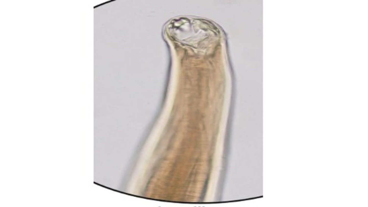 <p>Hookworm species with 1 pair of teeth that infects the SI of dogs & cats</p><p>-Percutaneous route of transmission = most significant</p><p>*Associated with Cutaneous larva migrans in humans</p>