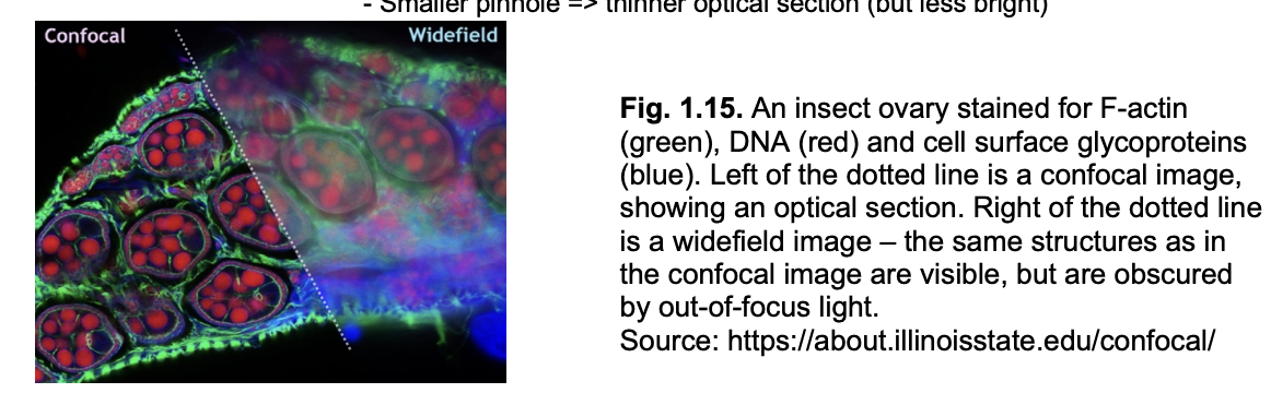 <p>Seeing inside organelles: types of fluoresecent miscrocopy methods</p>
