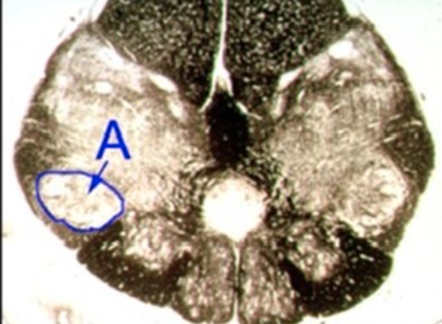 <p>Identify the structure indicated by the outline and letter "A."</p>