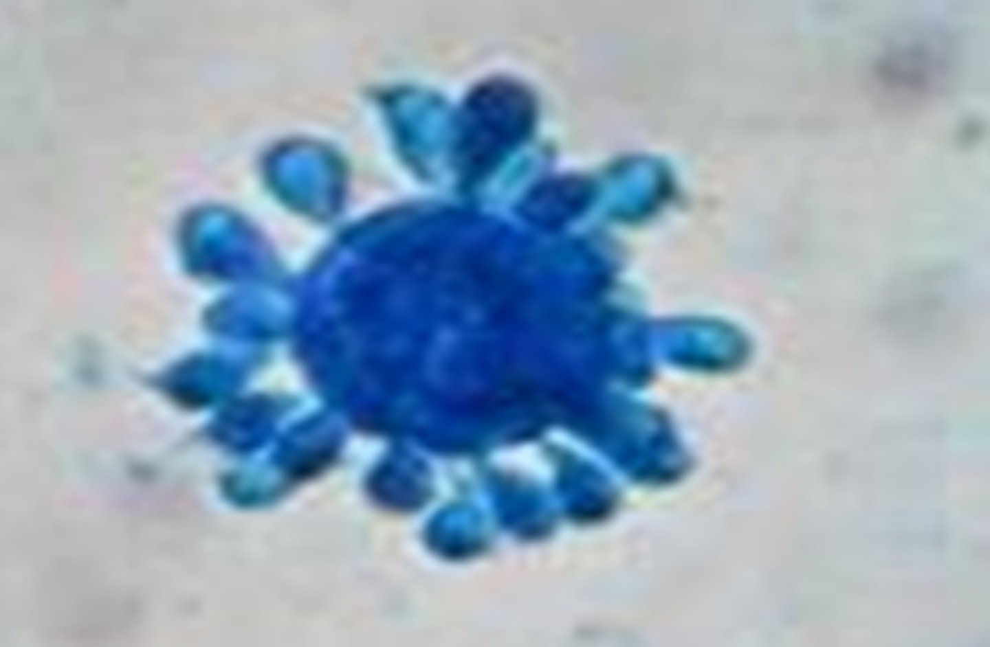 <p>Paracoccidioidomycosis</p><p>Infection: inhalation of conidia (disturbed soil)</p><p>--direct handling of plants</p><p>Sites of infection: pulmonary, lymphatics, mucous membranes</p><p>Estrogen protects against infection</p><p>"mariner's wheel"</p>