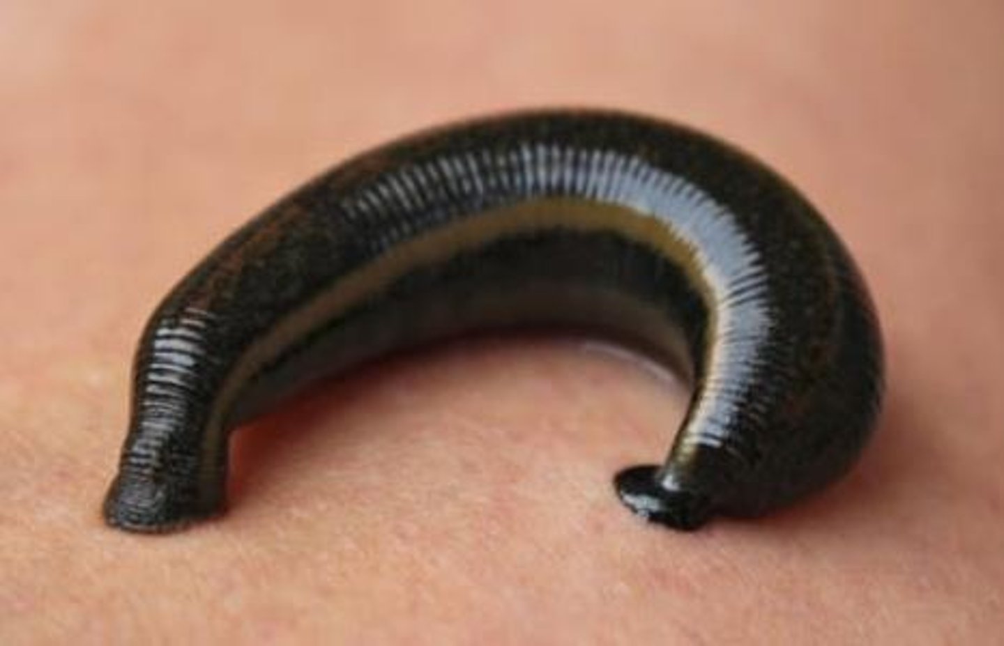 <p>A class of annelids that includes leeches, which are primarily freshwater and can be blood-sucking parasites.</p>