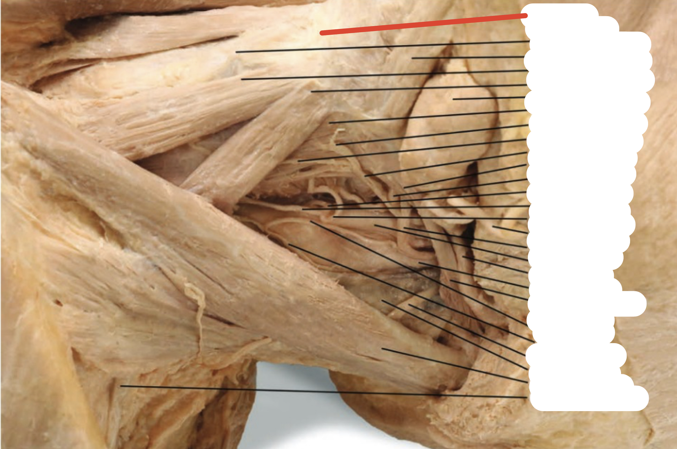 Identify the structure (red line)