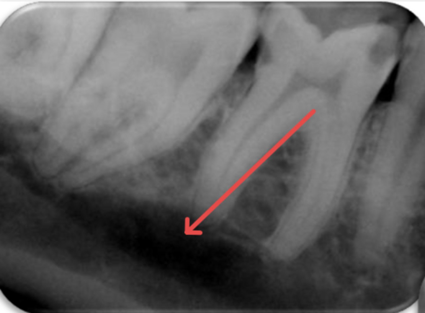 <p>ID the structure:</p>