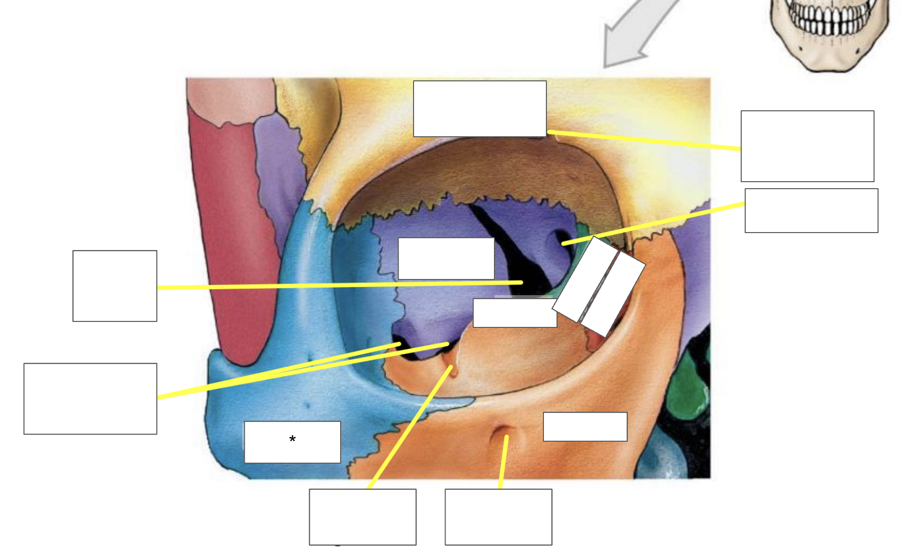 term image