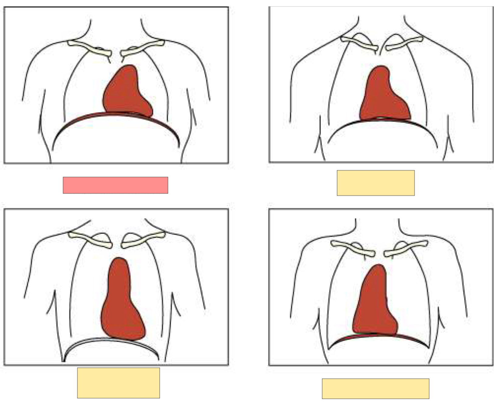 <p>What body habitus is this?</p>