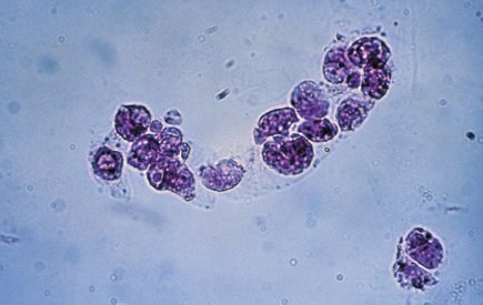 term image