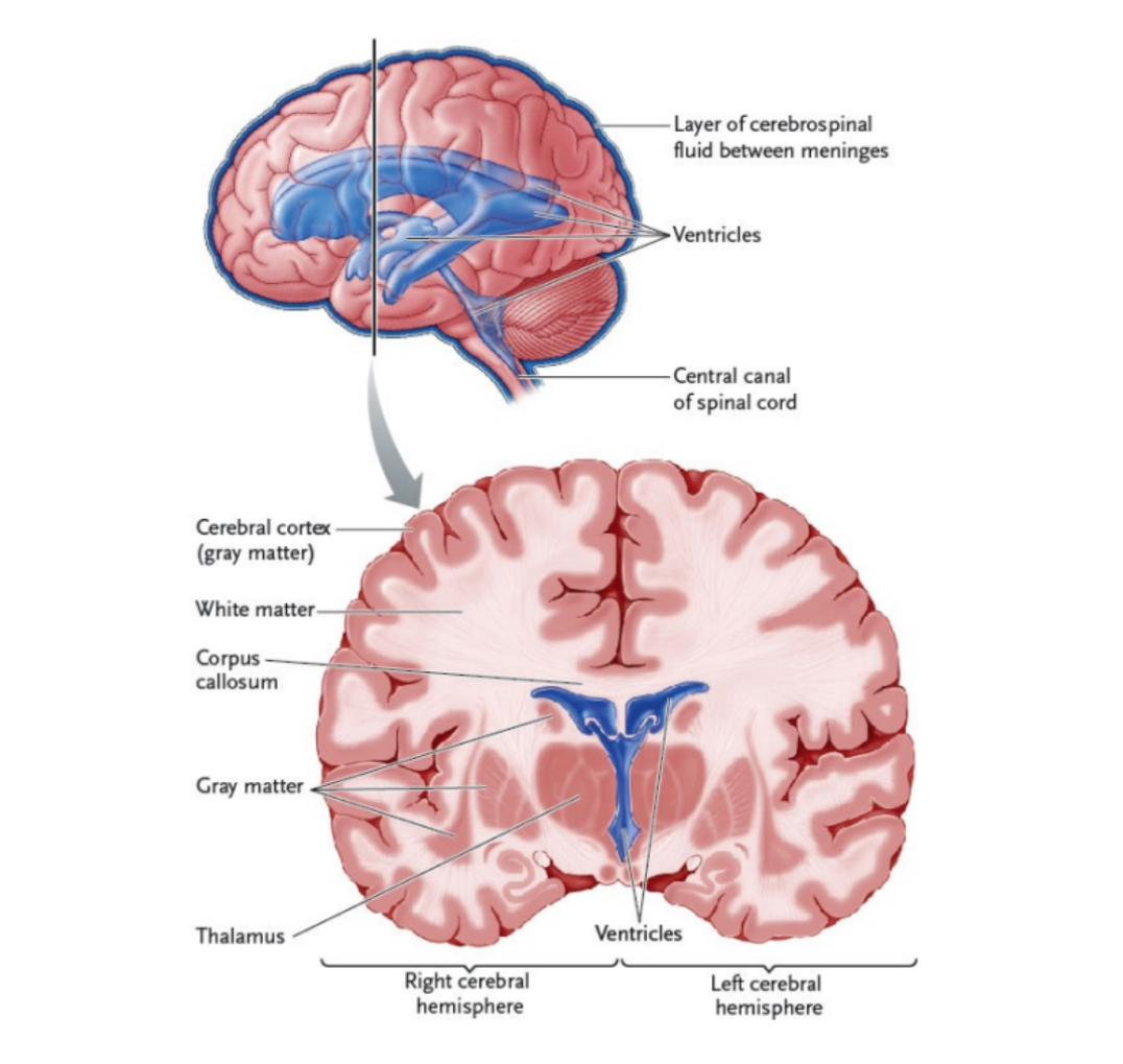<p>CNS </p><p>Grey matter: neu___ cell bo_____</p><ul><li><p>_0% of brain</p></li><li><p>No mye___ she___ </p></li><li><p>Cond___, proce_____ and sends in__ to bo__</p></li></ul><p></p><p>White matter: Bund____ ax____</p><ul><li><p>_0% of brain</p></li><li><p>Inter____s in__ from bo__</p></li></ul><p></p>