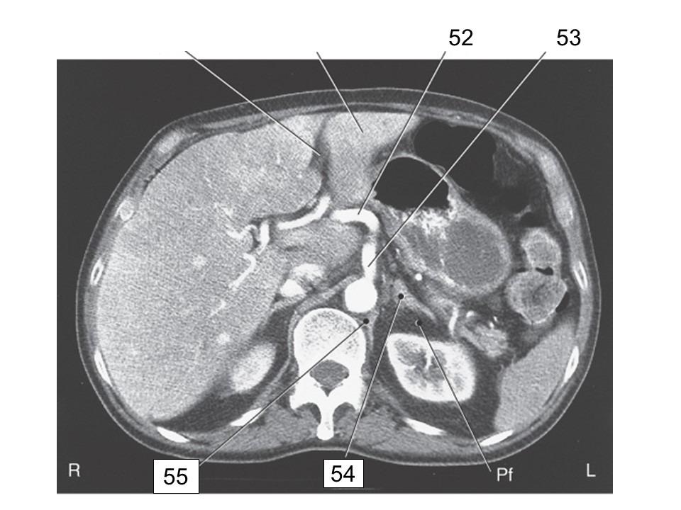 <p>identify 53</p>