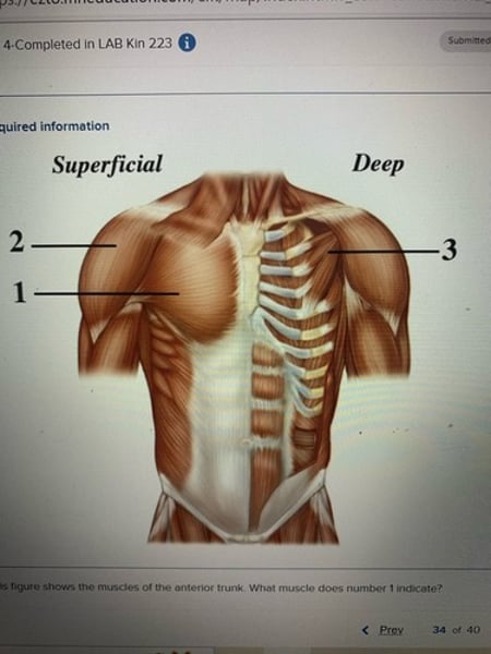 <p>Pectoralis major</p>