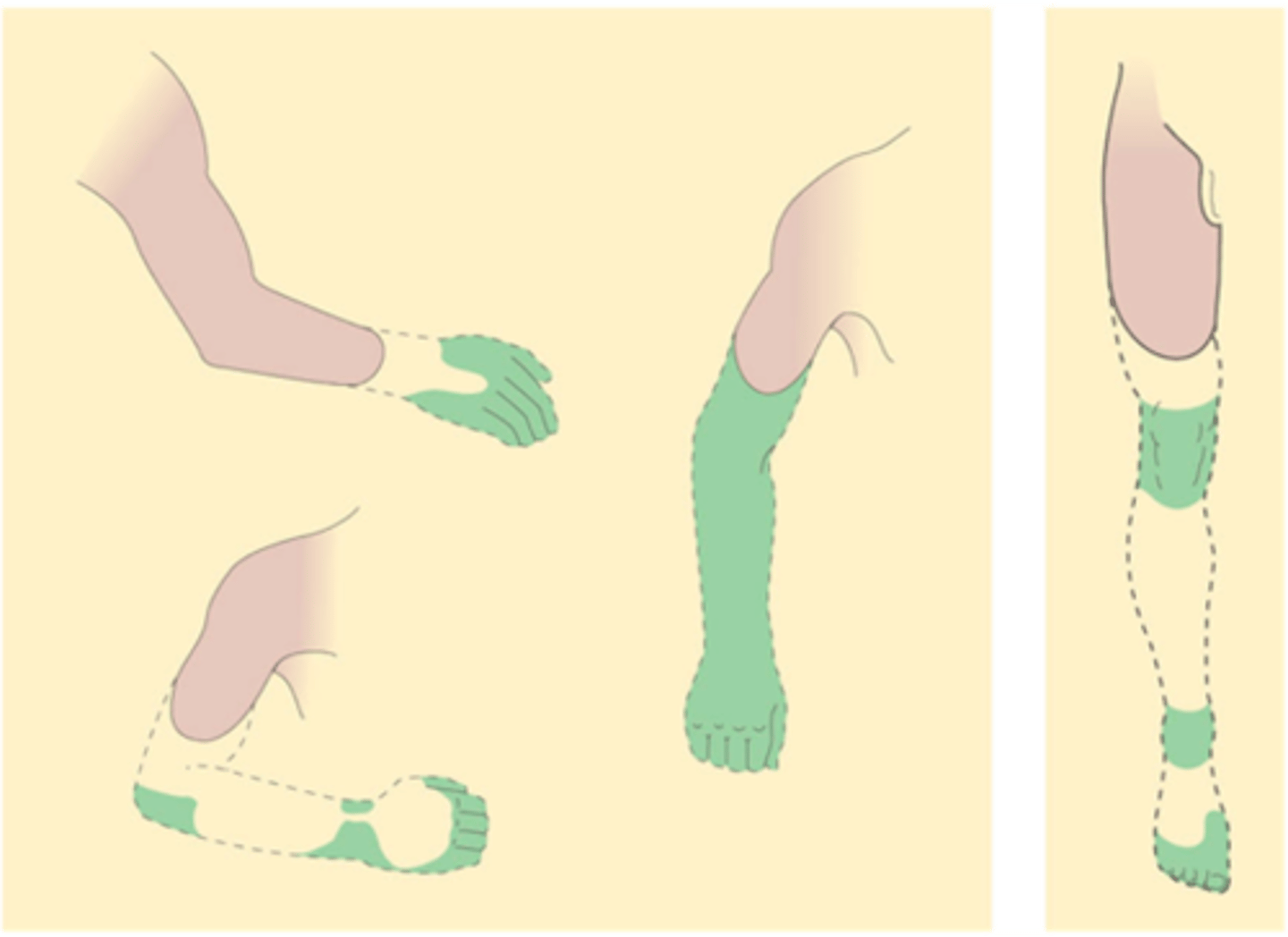 <p>Phantom limb pain clearly does not fit simply with _____________ _______</p>