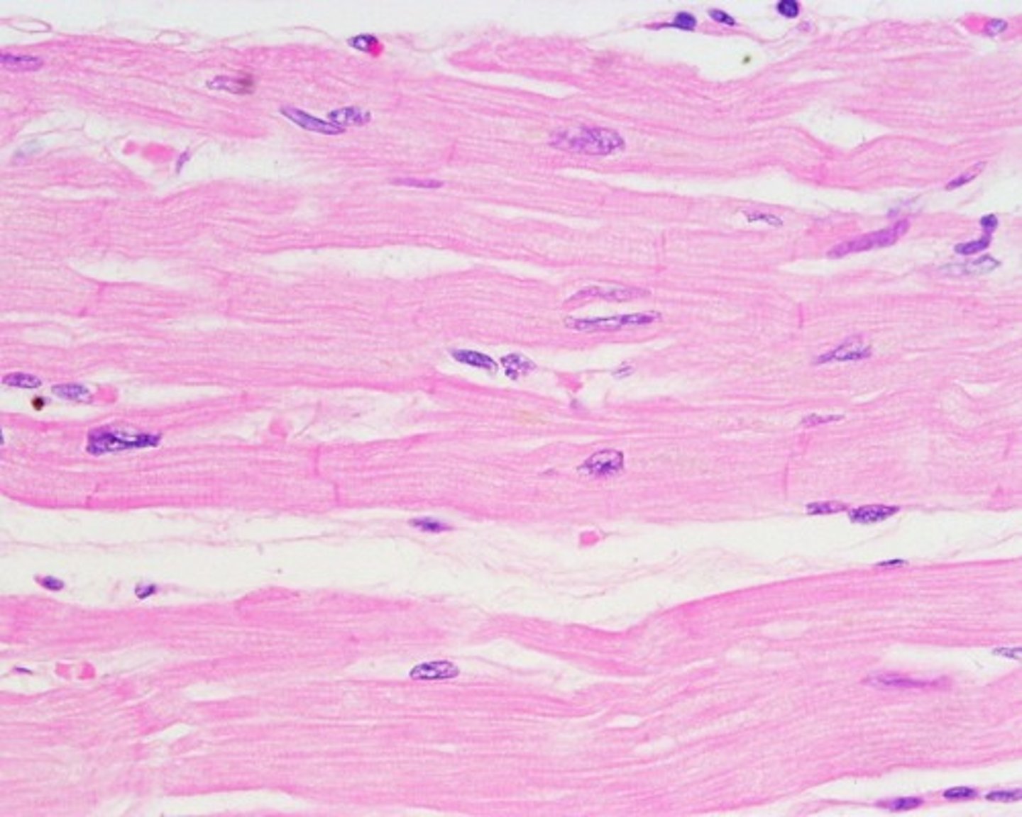 <p>Striations, branched cells, single central nuclei (uninucleate)</p>