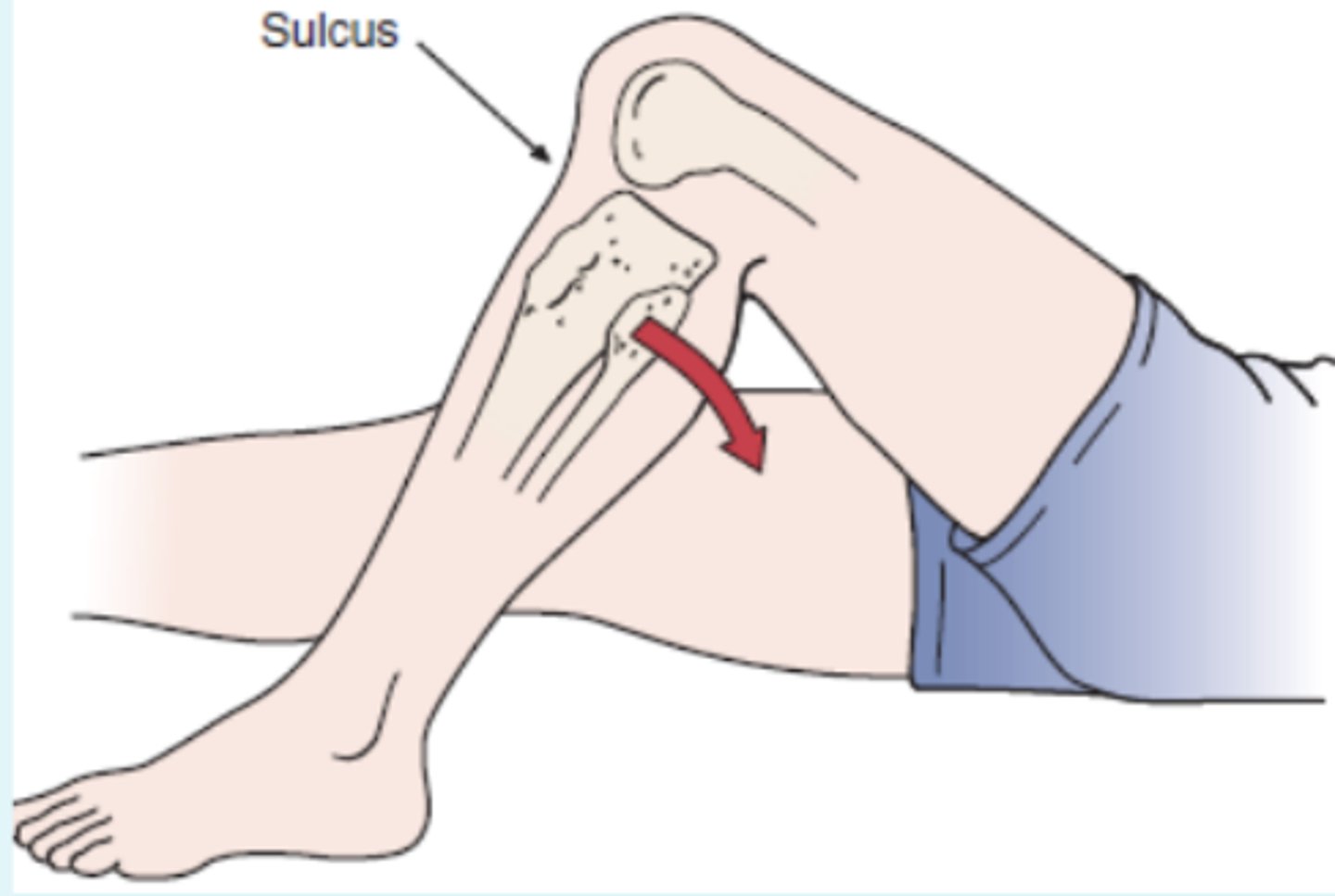 <p>- PCL</p><p>- pt lies supine with hip flexed to 45 and knee flexed to 90</p><p>(+): tibia drops back or sags back on femur because of gravity if PCL is torn</p>