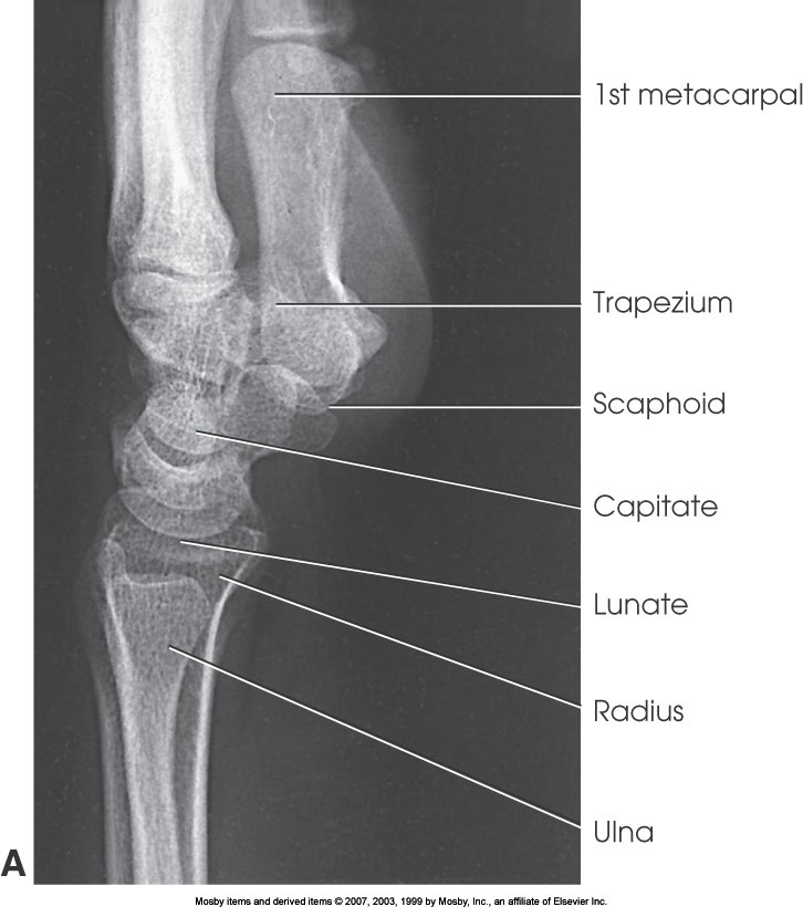 <p>What position is demonstrated?</p>