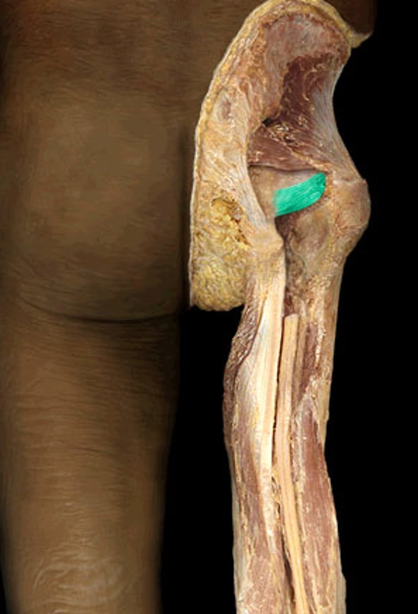 <p>Prevents hyperextension</p>