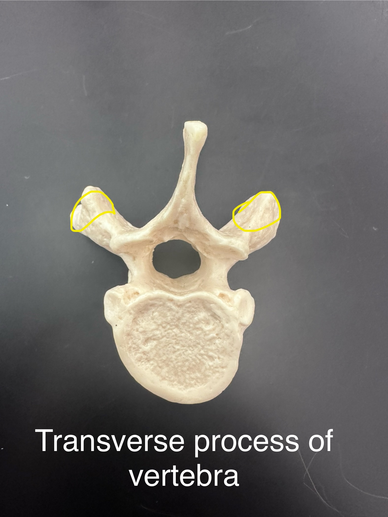 <p>Transverse Process</p>