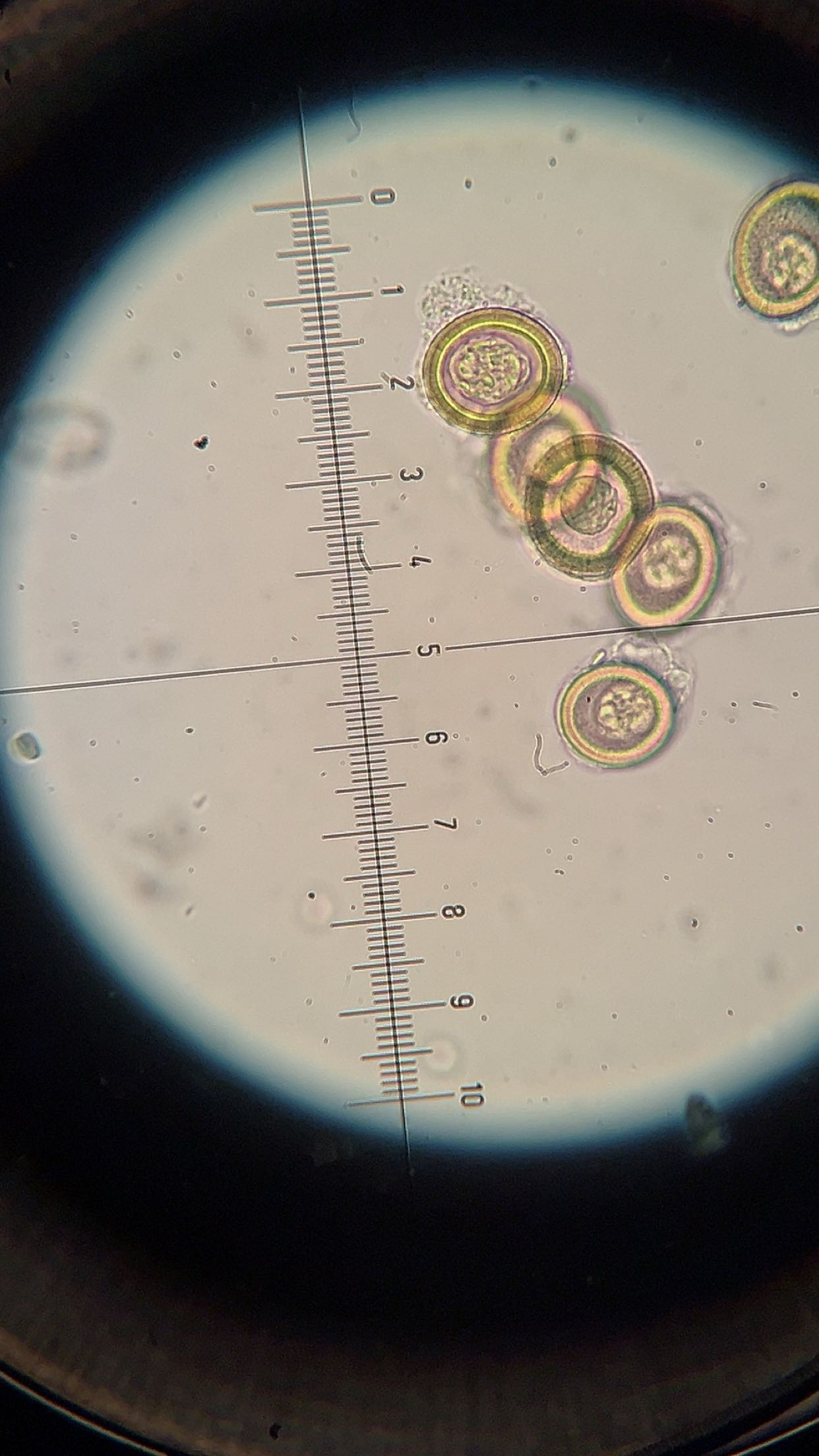 <p><em>Taenia pisiformis </em>egg</p>