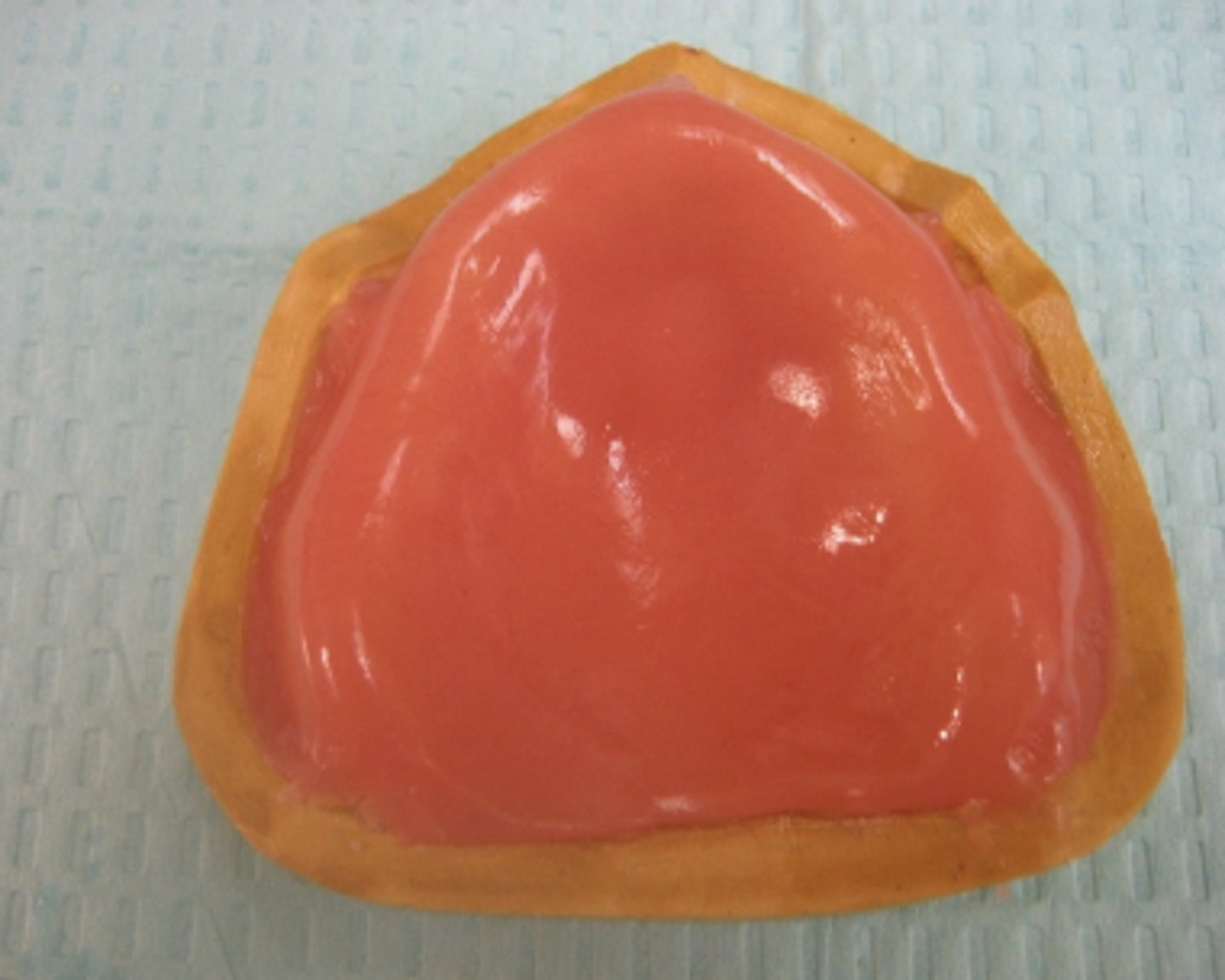 <p>When fabricating the maxillary record paces, be sure that the material completely fills the ___________ areas and is straight across the posterior aspect of the cast.</p>