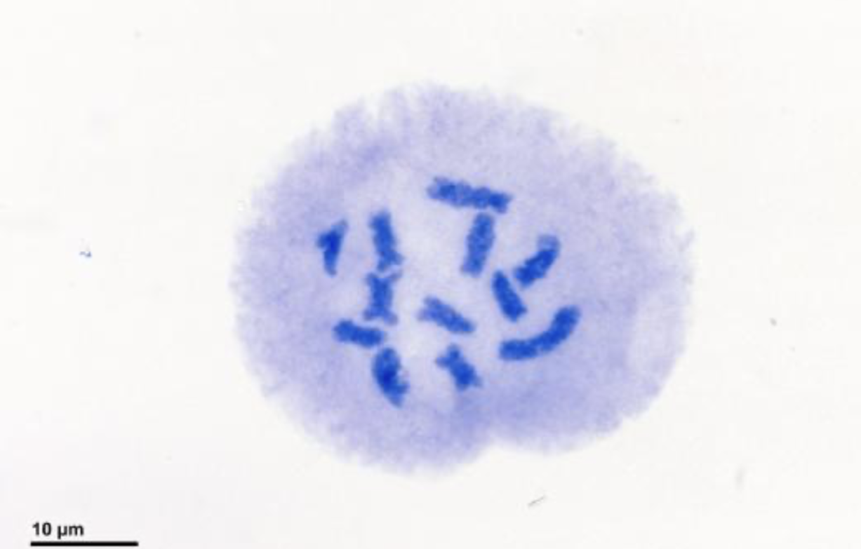 <p>what stage of cell division is this?&nbsp;</p>