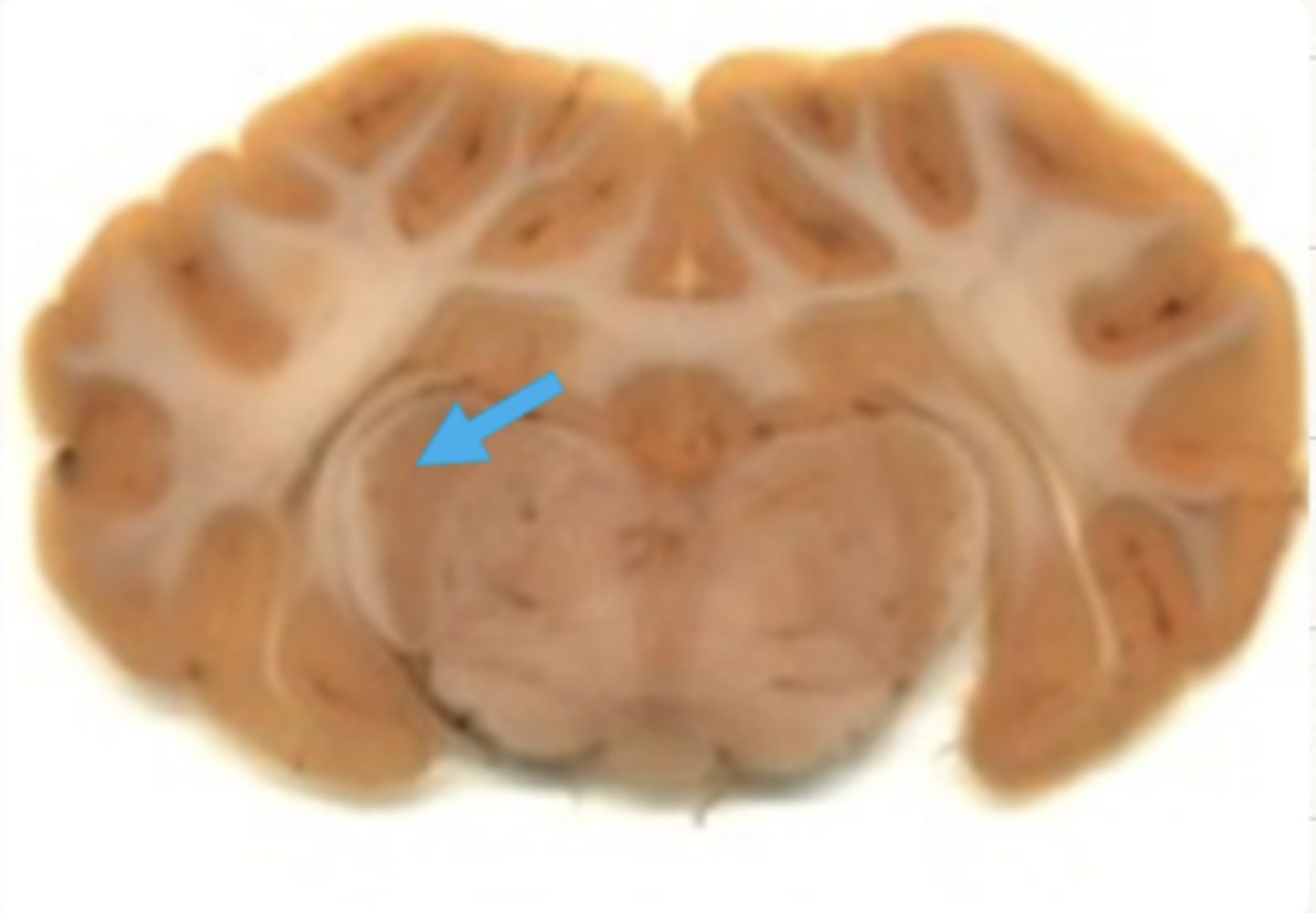 <p>what structure is labeled with a blue arrow?</p>