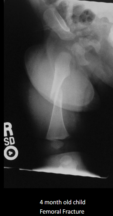 <p>Skeletal survey (not a ‘babygram’).</p>