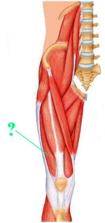 <p><span>Identify the indicated muscle.</span></p>