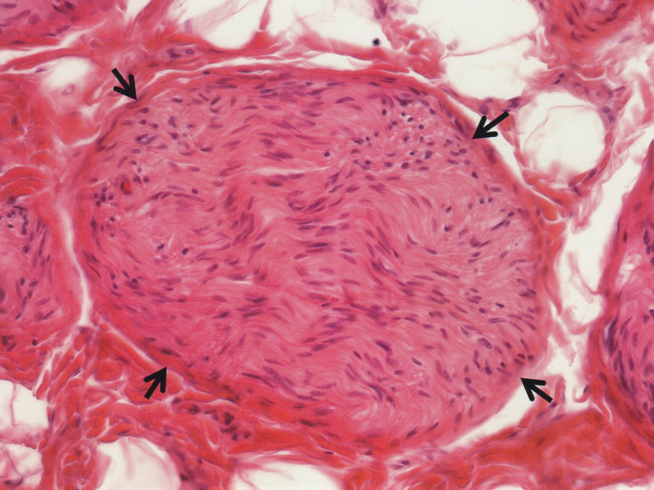 <p>C. A peripheral nerve</p>