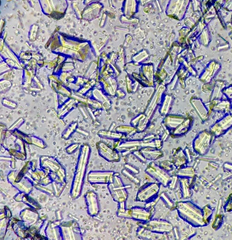 <p>You see this on a urinalysis of a patient taking a sulfa drug. How did the drug cause this?</p>