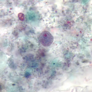 <p>This ameba is more easily identified by its quadrinucleate cyst. Identify its 9 µm trophozoite shown below:<br><br></p><p>Dientamoeba fragilis</p><p>Endolimax nana</p><p>Entamoeba hartmanni</p><p>Entamoeba histolytica</p><p>Iodamoeba bütschlii</p>