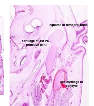 <p>-condylar process of developing TMJ</p><p>-sits in same periosteal membrane the rest of the mandible was in</p>