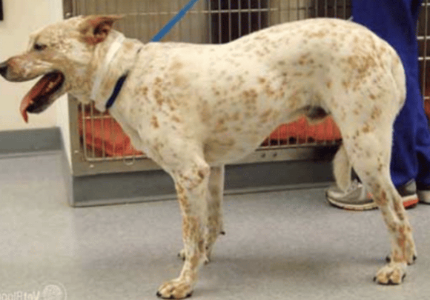 <p>This stance is highly indicative of what pathology?</p>