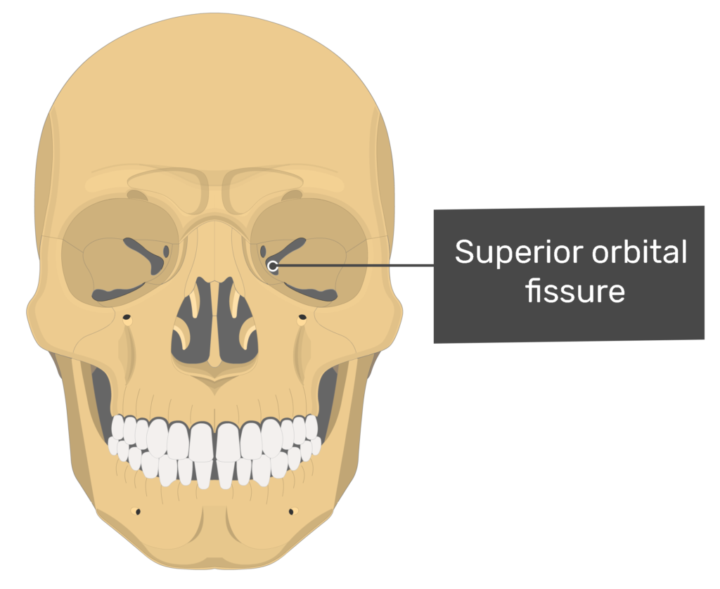 <p>Slit within a bone or between bones</p>
