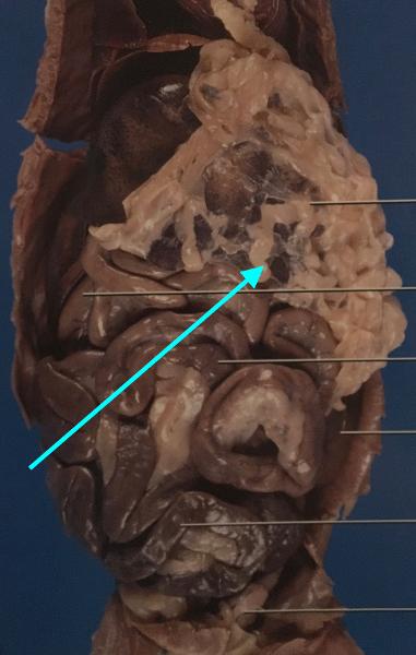 <p>The greater and lesser omentum are folds of connective tissue that hang from the stomach and cover the abdominal organs. They provide support and protection for the organs and also play a role in immune response.</p>