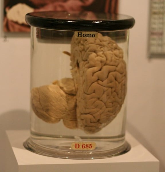 <p>The base of the brainstem. Controls heartbeat and breathing.</p>