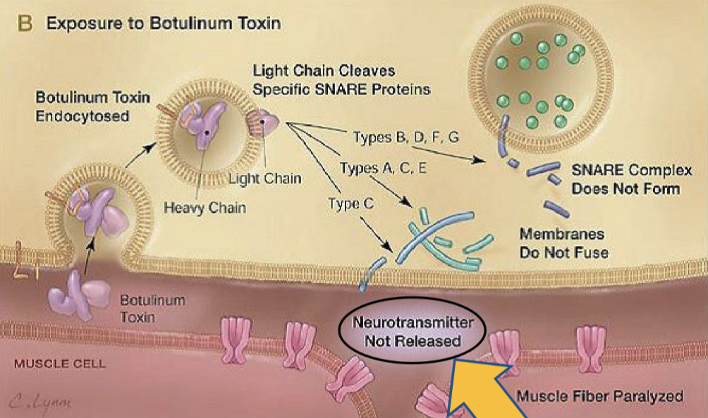 <p>Botulism toxin, it works by cleaving specific SNARE proteins (used to anchor the synaptic vesicles against the cell membrane to release neurotransmitters)</p>