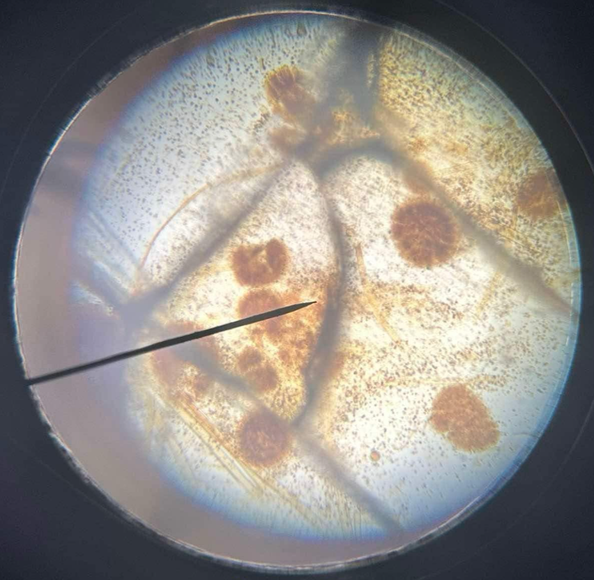 <p>Zygomycetes species commonly known as black bread mold</p>