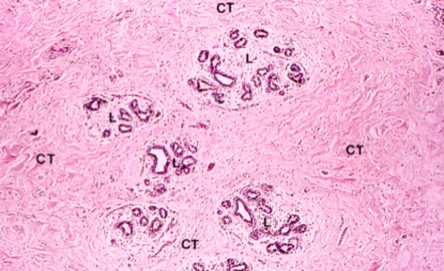 <p>Active or inactive mammary gland?</p>