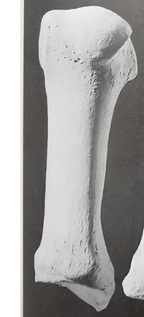 <p>only lateral side as articular facet— if you hold dorsally facet is on side it’s from; flatter side + end of “africa” of base are on side it’s from</p>