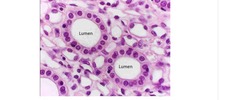 -Single layer of boxy cells
- Allows for absorption, secretion
FOUND- Kidney tubules