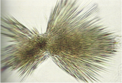 <p>Abnormal crystals: Tyrosine</p>