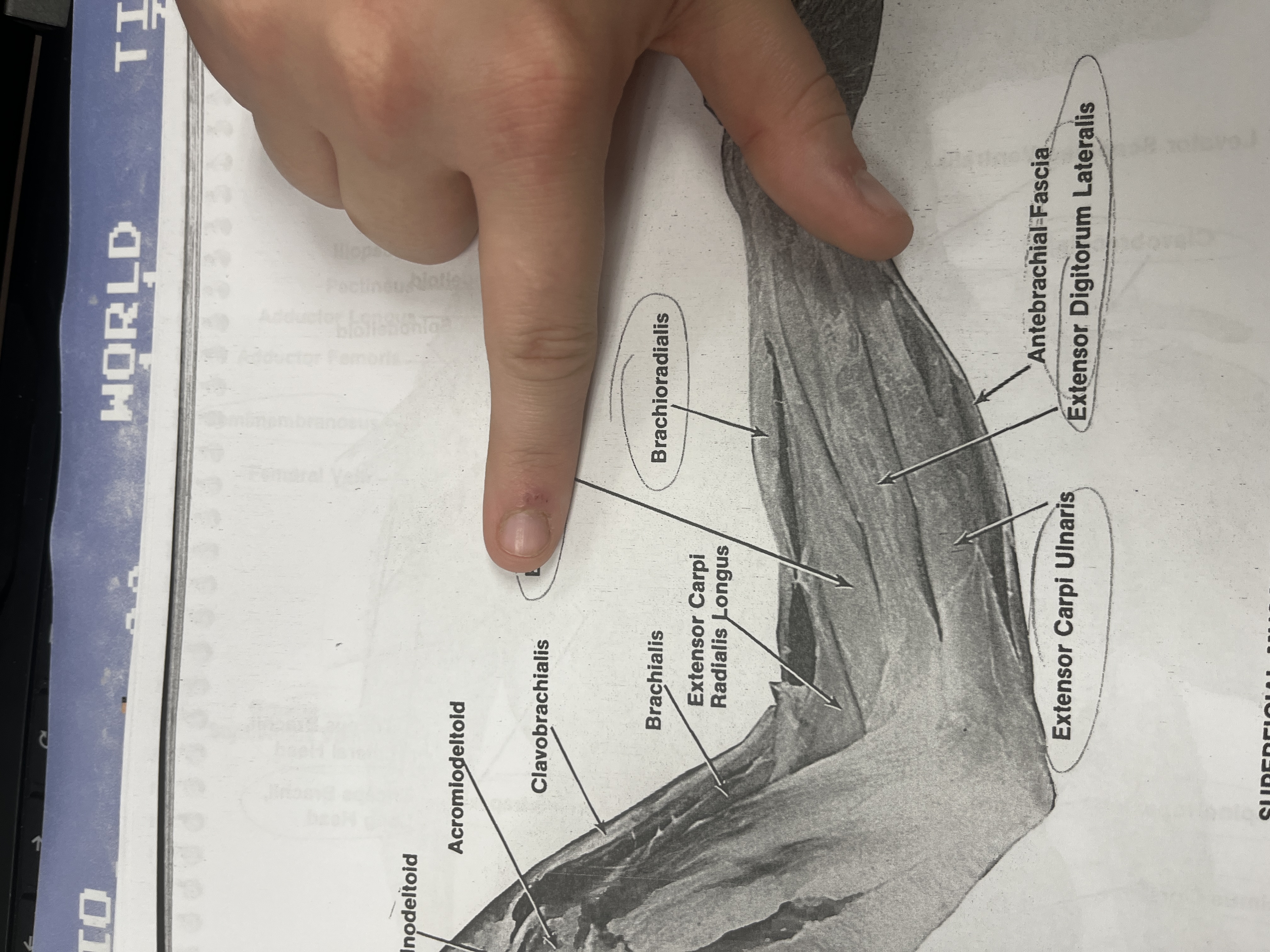 <p>A muscle that extends the fingers.</p>