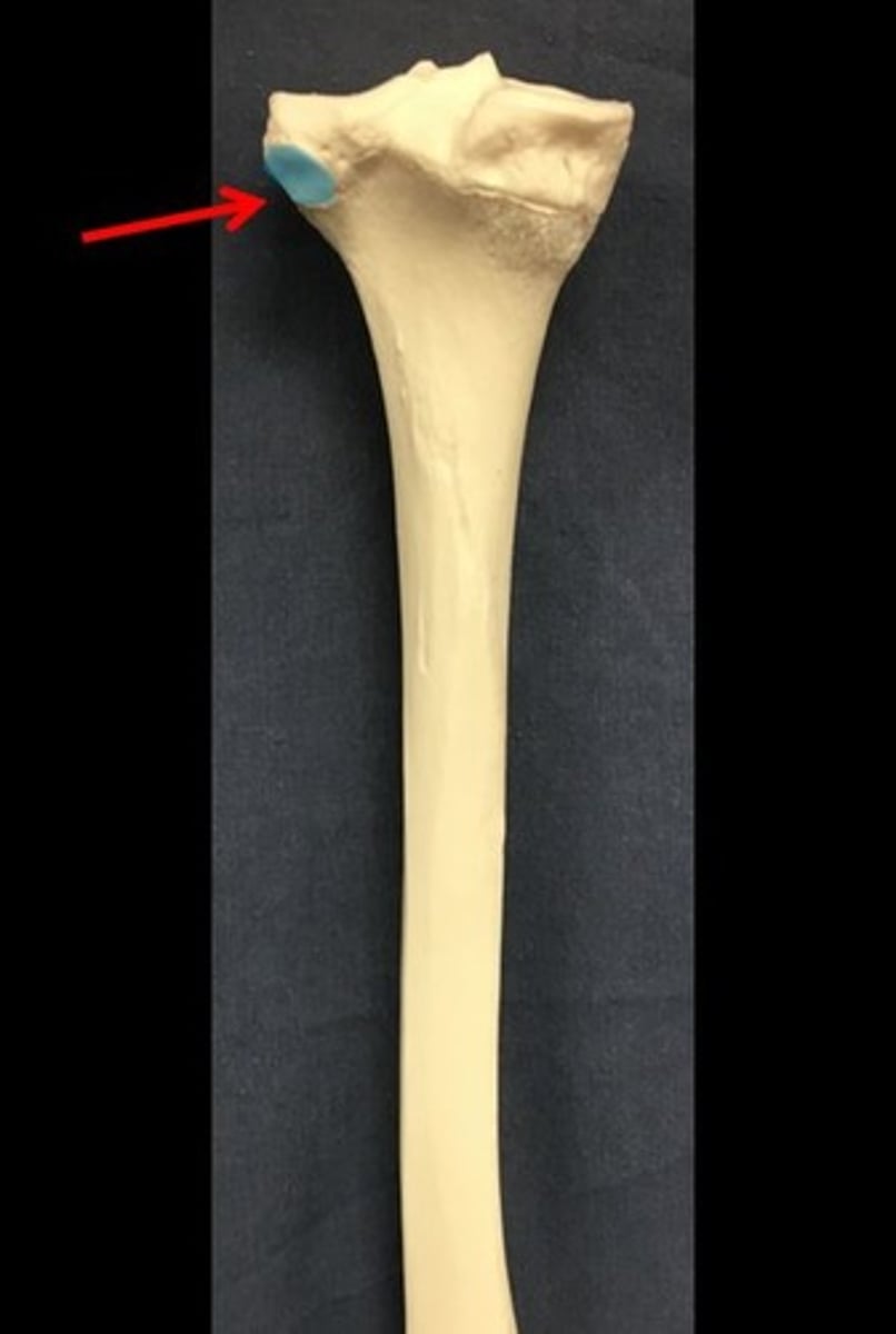 <p>on proximal tibia; articulation site for head of fibula</p>