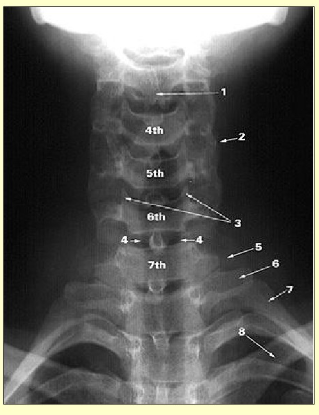 <p>Label this image </p>