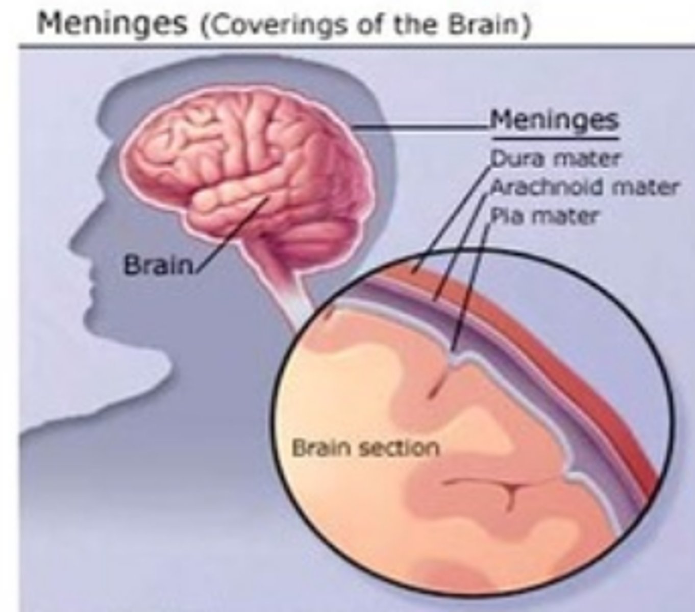 <p>inflammation of the meninges covering the brain and spinal cord</p>