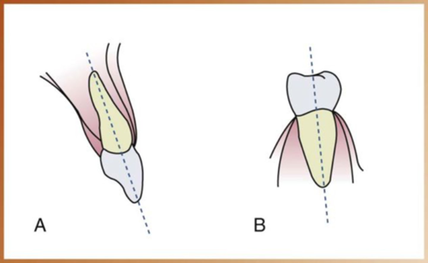 <p>imaginary line of the tooth that divides in two equal parts</p>