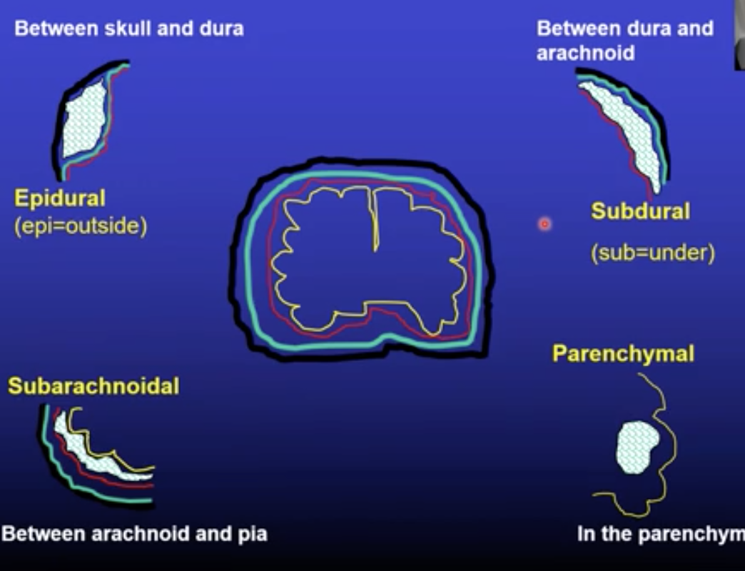 Epidural (between skull and dura) 

Subdural (between dura and arachnoid) 

Subarachnoidal (between arachnoid and Pia) 