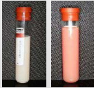 <p>Body cavity effusions</p><p>What is this? Why?</p>