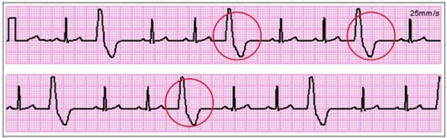 knowt flashcard image