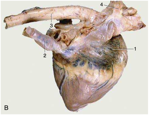 R heart, 1