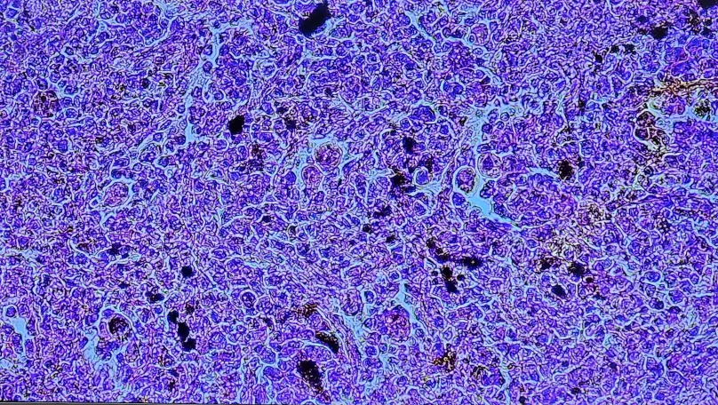 <p><span data-name="microscope" data-type="emoji">🔬</span><span data-name="petri_dish" data-type="emoji">🧫</span><strong><span> </span>Na podstawie zdjęcia preparatu:</strong></p><p></p><ul><li><p><span>📖 </span>rozpoznaj gatunek pasożyta;</p></li></ul><p></p><ul><li><p><span>♻ </span>rozpoznaj wszystkie formy rozwojowe;</p></li></ul><p></p><ul><li><p><span>🦠 </span>wskaż organelle i cechy charakterystyczne dla danego gatunku;</p></li></ul><p></p><ul><li><p><span>😷 </span>nazwij chorobę, którą pasożyt wywołuje.</p></li></ul><p></p>