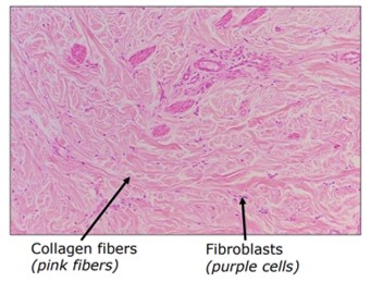 <p>What tissue is shown</p>